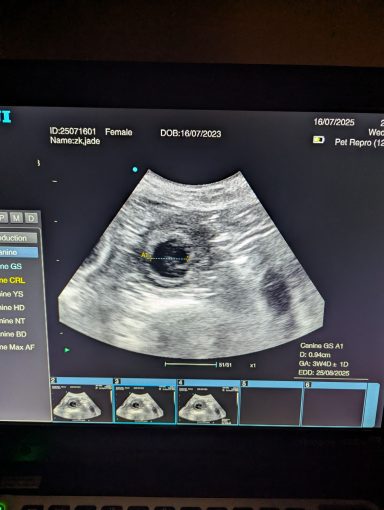 pregnancy confirmation scan